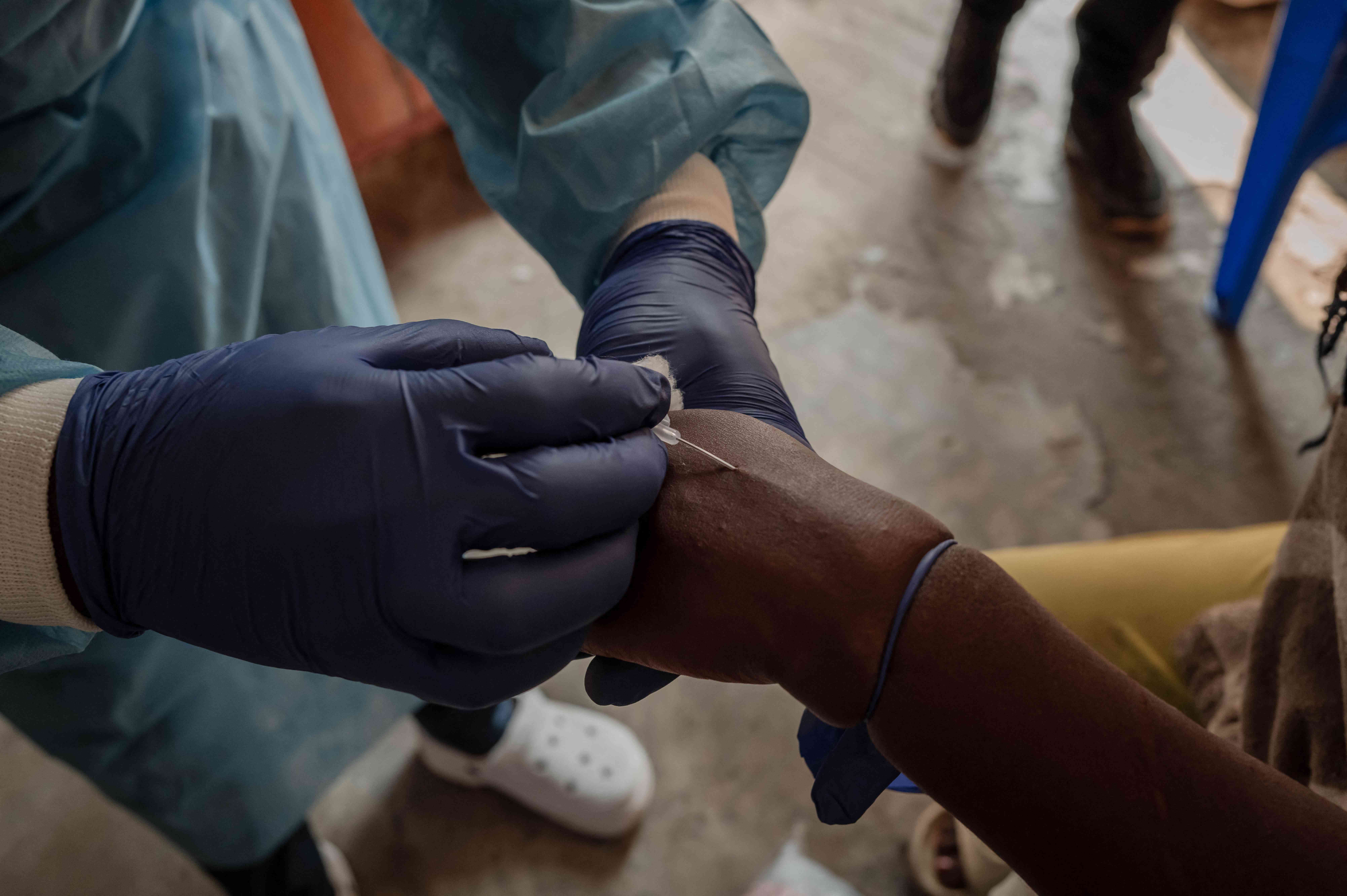 A health worker takes a sample at the Mpox treatment centre of the Nyiragongo general referral hospital, north of the town of Goma in the Democratic Republic of Congo, on August 16, 2024.